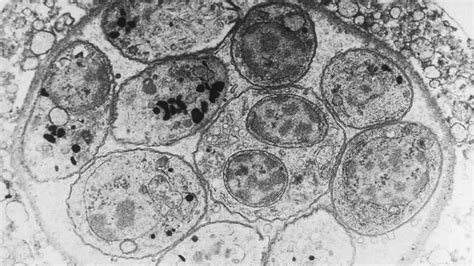 Toxoplasma gondii: Un Parasito Cunning que Puede Controlar Mentes!