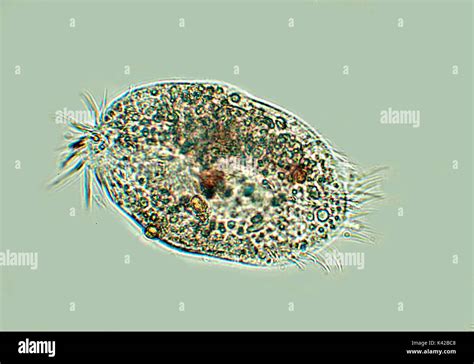  Urocentrid: Un pequeño gigante ciliado que te sorprenderá con su voracidad microscópica