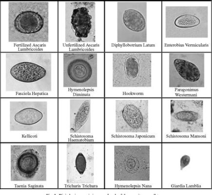  Eimeria: ¡Una mirada microscópica al mundo de los parásitos intestinales!