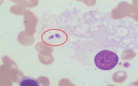   Leishmania: ¡Un parasito microscópico que provoca grandes problemas de salud!